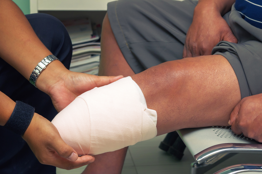 wond care for leg amputation_skin graft