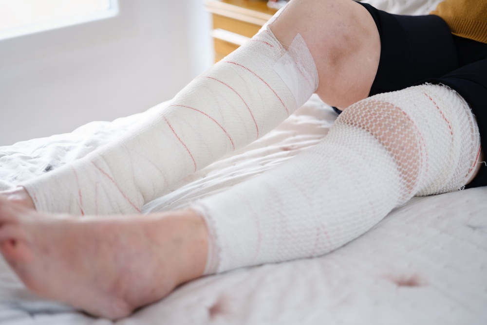 Wound Care, Diabetic Wounds, Limb Salvage, Reconstructive Surgery